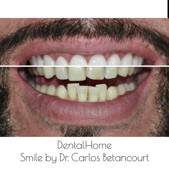Clínica Dental Home - Diseño de Sonrisa Medellin