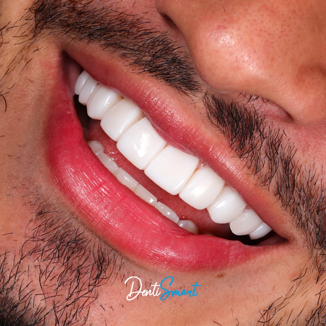 DentiSmart