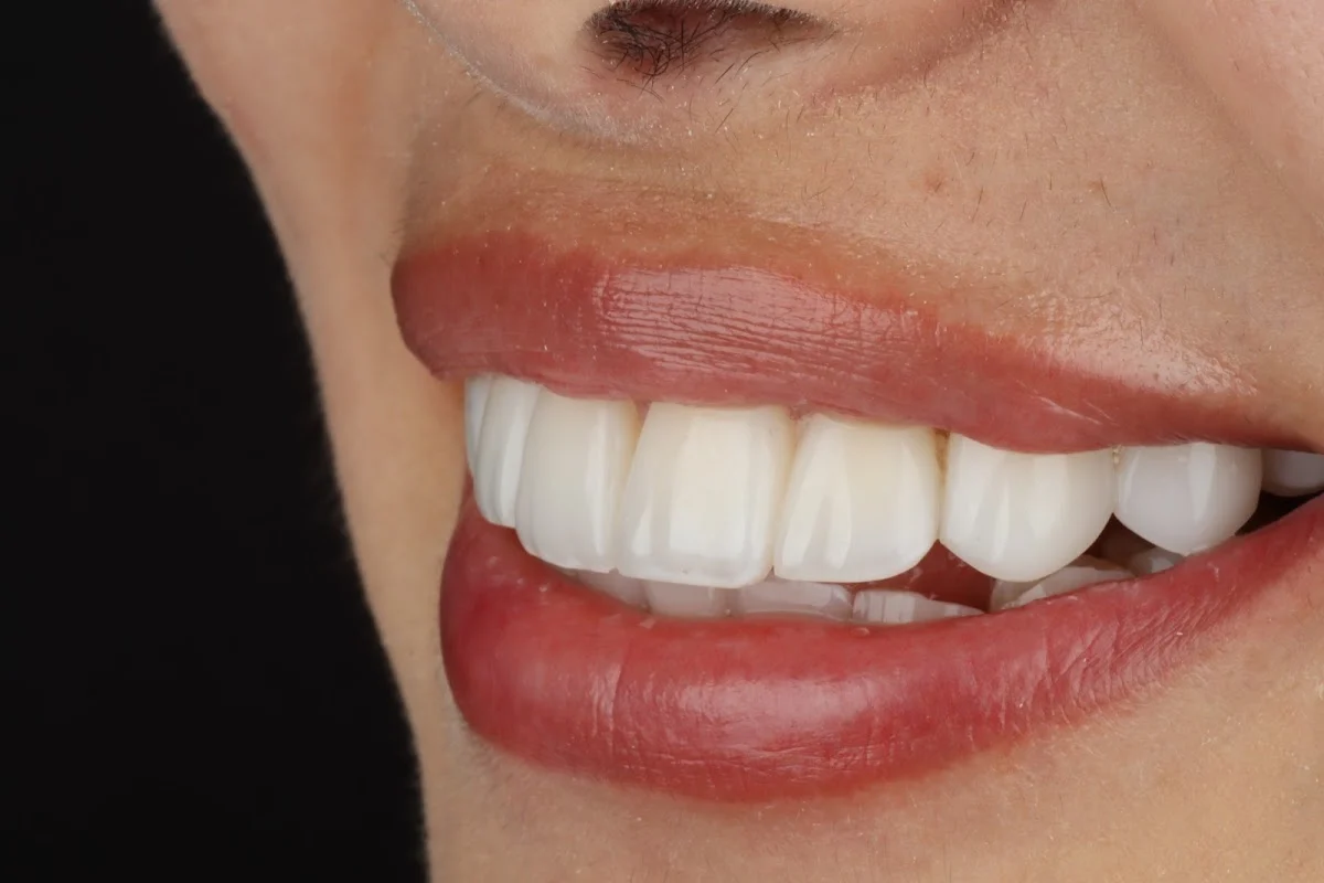 ZÉNTICA | DENTAL STUDIO | ODONTOLOGÍA ESTÉTICA ESPECIALIZADA